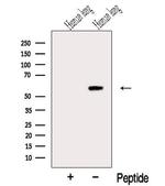 RASSF10 Polyclonal Antibody
