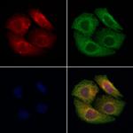 MMP24 Polyclonal Antibody