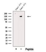 COL5A2 Polyclonal Antibody