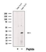 TMEM158 Antibody in Western Blot (WB)