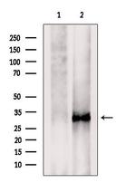 TMEM158 Antibody in Western Blot (WB)