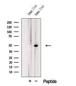 JMJD5 Polyclonal Antibody