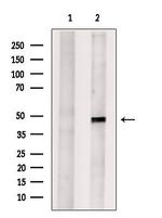 JMJD5 Antibody in Western Blot (WB)