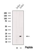MFAP5 Antibody in Western Blot (WB)