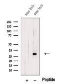 TMEM9 Polyclonal Antibody