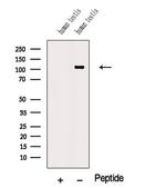 NUTM1 Polyclonal Antibody