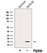 Neuritin Antibody in Western Blot (WB)