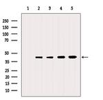 Neuritin Polyclonal Antibody