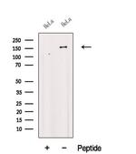 FBXL10 Polyclonal Antibody