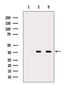 MSI2 Polyclonal Antibody