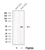 ACTR10 Polyclonal Antibody