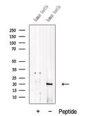 ADI1 Polyclonal Antibody