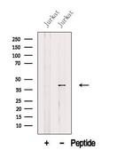 AUP1 Polyclonal Antibody