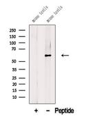 BBS9 Antibody in Western Blot (WB)