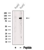 BBX Antibody in Western Blot (WB)