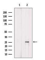 BTG1 Polyclonal Antibody