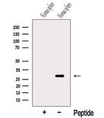 TIMM21 Antibody in Western Blot (WB)