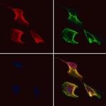 CCDC120 Polyclonal Antibody