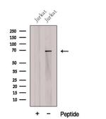 CCDC120 Antibody in Western Blot (WB)