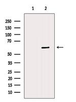 CHDH Antibody in Western Blot (WB)