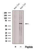 CHDH Antibody in Western Blot (WB)