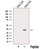 CHMP2B Polyclonal Antibody