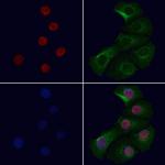 COMMD5 Polyclonal Antibody