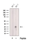COMMD5 Antibody in Western Blot (WB)