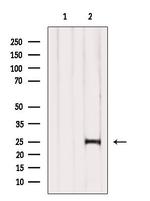 COMMD5 Antibody in Western Blot (WB)
