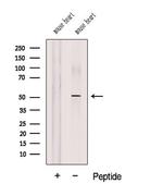 COQ6 Polyclonal Antibody