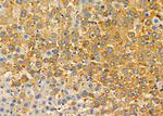 CPOX Polyclonal Antibody