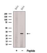 DCUN1D5 Antibody in Western Blot (WB)