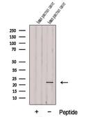 DDIT4L Polyclonal Antibody