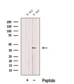 DUSP11 Polyclonal Antibody