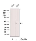 EIF3M Polyclonal Antibody