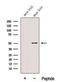FADS1 Polyclonal Antibody