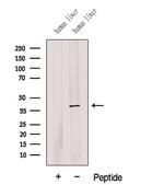 G6PC Polyclonal Antibody