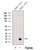 Galectin 2 Polyclonal Antibody