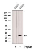 Gemin 6 Polyclonal Antibody