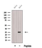 GSTA2 Antibody in Western Blot (WB)