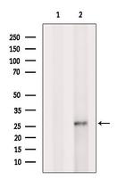 GSTA2 Polyclonal Antibody