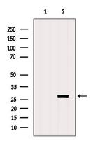 GSTO2 Antibody in Western Blot (WB)