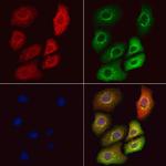 GSTT2B Polyclonal Antibody