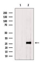 GSTT2B Antibody in Western Blot (WB)