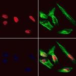 HDGFRP3 Polyclonal Antibody