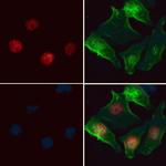 HELLS Polyclonal Antibody