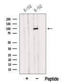 HELLS Antibody in Western Blot (WB)