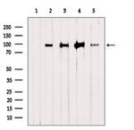 HELLS Antibody in Western Blot (WB)