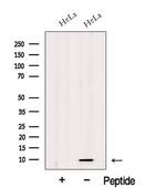 HIGD1A Polyclonal Antibody