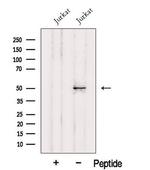 HMG20A Polyclonal Antibody